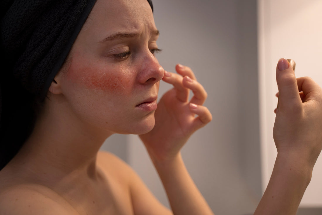 Woman concerned about redness and irritation 